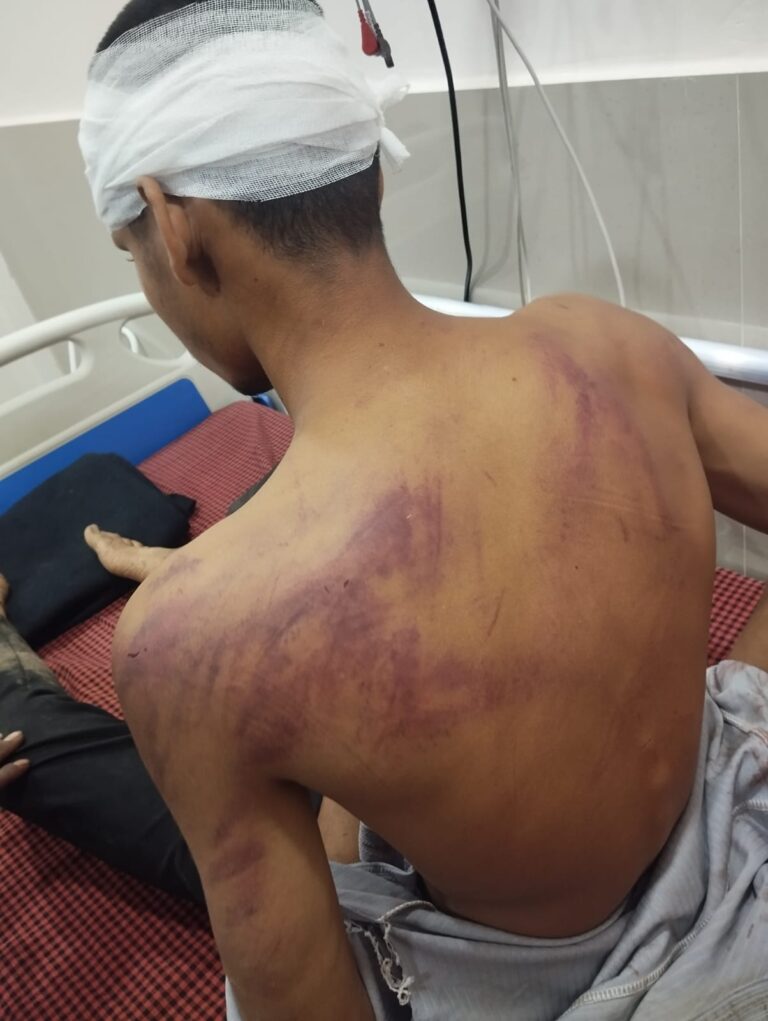 बारात में बवाल: डीजे पर नाचने को लेकर विवाद, जमकर मारपीट, दो युवक गंभीर रूप से घायल।
